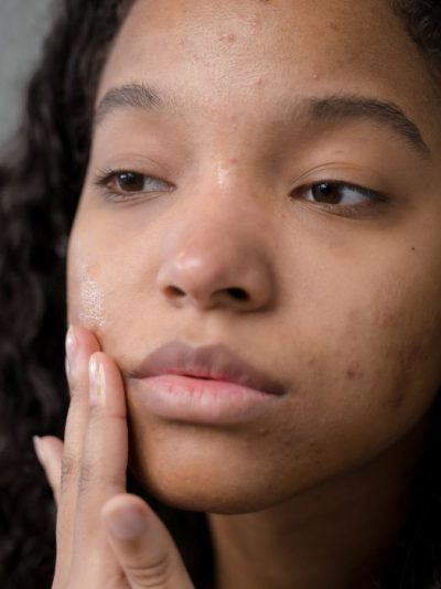 Barrier Recovery – For Sensitive Skin